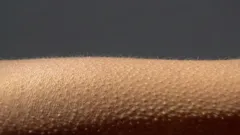 Fenomeno neurobiologico: perché compaiono i brividi sulla pelle?